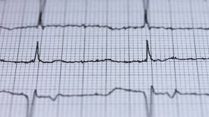 Quelle Est La Fréquence Cardiaque Normale En Fonction De L’âge